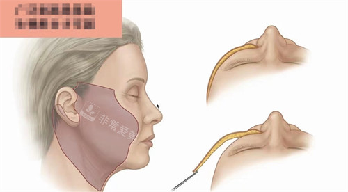 韓國奉恩寺路哪家皮膚...