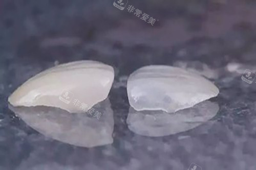 樹脂和全瓷貼片實物示意圖 樹脂和全瓷貼片實物示意圖