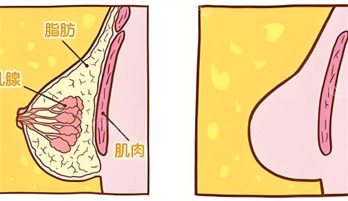 乳房組織