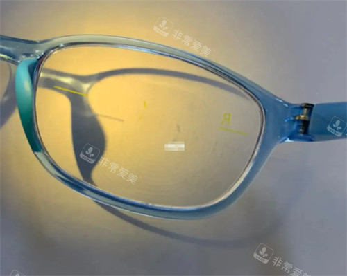 蔡司小乐园眼镜图