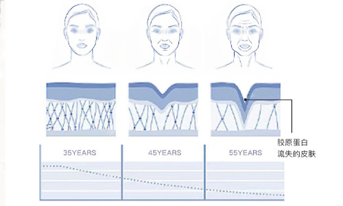 膠原蛋白流失的皮膚