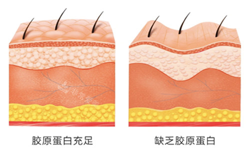 膠原蛋白