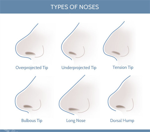 不同形态的鼻子