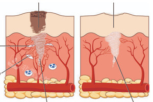 不同情况的疤痕在皮肤上的表现