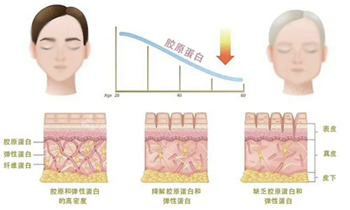 胶原蛋白流失