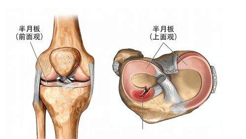 半月板的多方位展示图