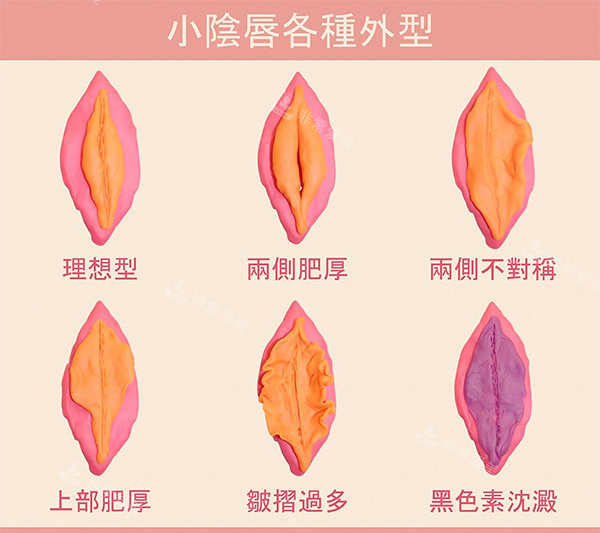 不同女性私密陰唇照片