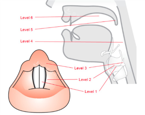 聲音整形-聲帶結(jié)構(gòu)圖解