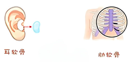 隆鼻耳軟骨鼻肋骨鼻取材區(qū)別