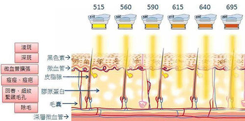 光子嫩膚原理圖