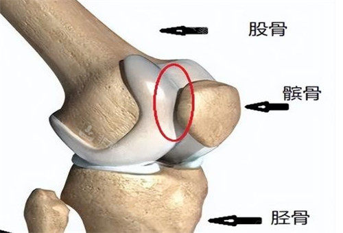 膝關節(jié)骨頭剖析圖