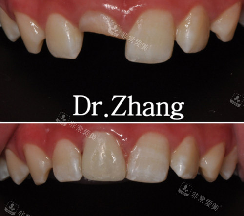 輝縣市小貝殼口腔牙齒修復(fù) 輝縣市小貝殼口腔牙齒修復(fù)