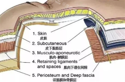 面部皮下組織層圖解