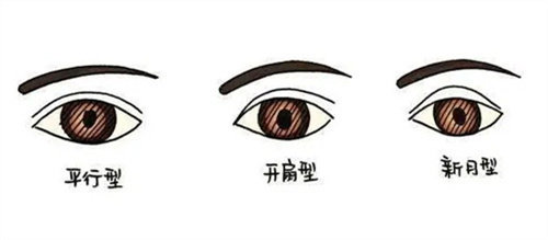 双眼皮