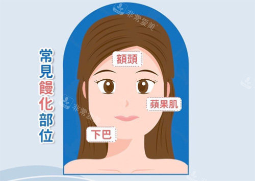 馒化脸常见部位