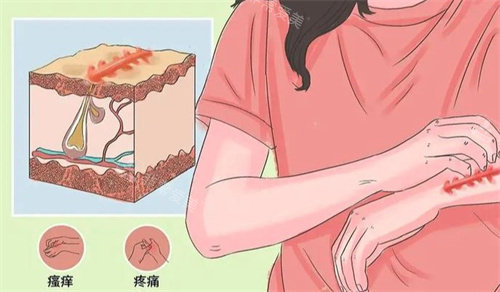 疤痕 疤痕