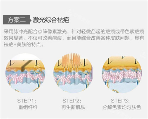 激光祛疤圖示 激光祛疤圖示