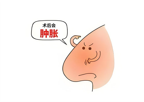 隆鼻術(shù)后腫脹動(dòng)畫圖