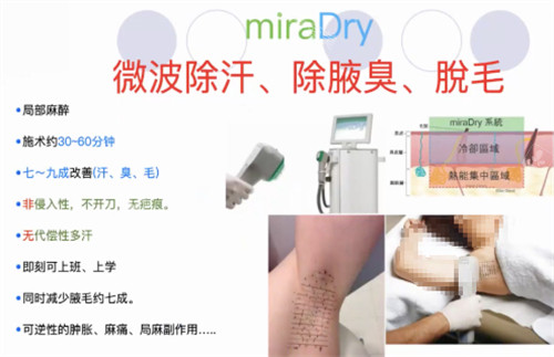 miraDry清新微波治疗过程