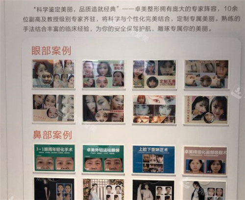 武汉硚口卓美整形展示墙