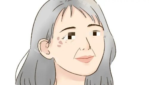 真皮斑漫畫示意圖 真皮斑漫畫示意圖