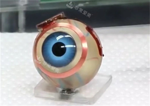 仿生眼球的样子
