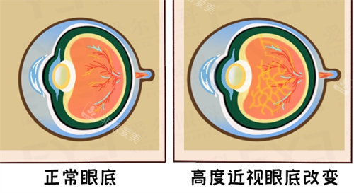 眼底视力呈现
