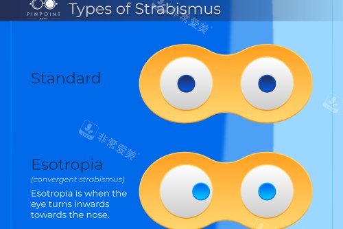 正常眼对比斜视眼