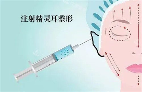 精靈耳注射動畫圖 精靈耳注射動畫圖