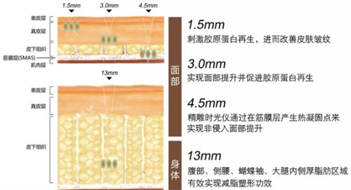 意大利時光術可深入的皮膚層次