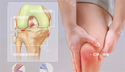 膝蓋受損治療方法 膝蓋受損治療方法
