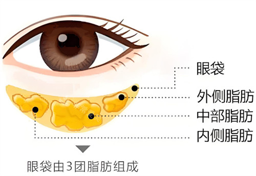 眼袋構(gòu)成 眼袋構(gòu)成