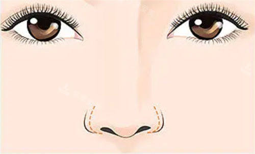 鼻部形态展示图