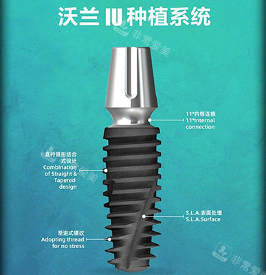 沃兰种植体