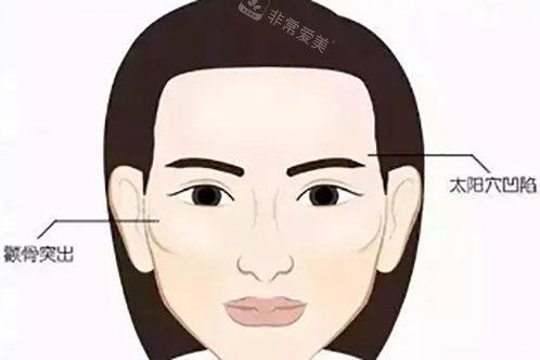 韩国创造美整形医院怎...