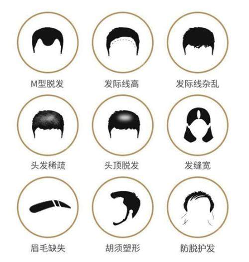 各種需要植發(fā)的情況圖 各種需要植發(fā)的情況圖