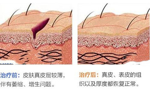 武漢友好醫(yī)院疤痕科做...