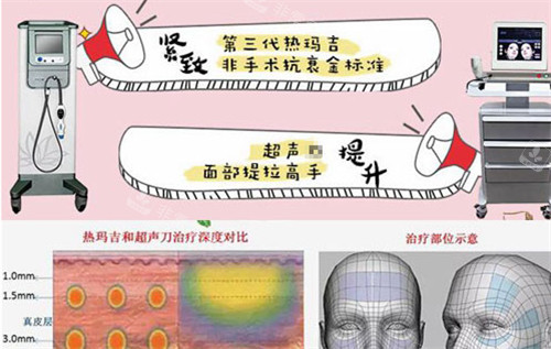 熱瑪吉與超聲儀器抗衰的作用圖解 熱瑪吉與超聲儀器抗衰的作用圖解