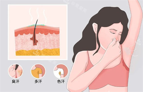 狐臭有哪些癥狀 狐臭有哪些癥狀