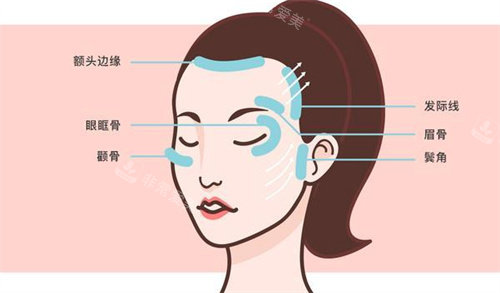 面部提升区域 面部提升区域