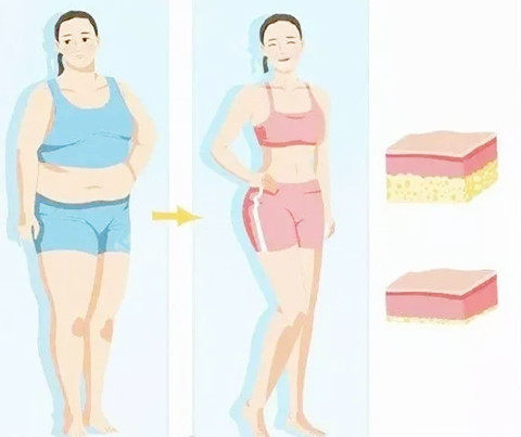 吸脂卡通對比 吸脂卡通對比