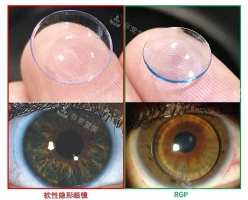 rgp和隐形眼镜区别