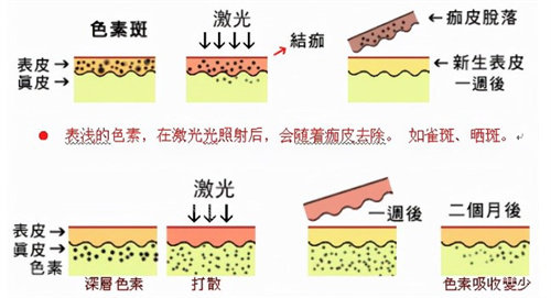 皮秒的原理素材 皮秒的原理素材