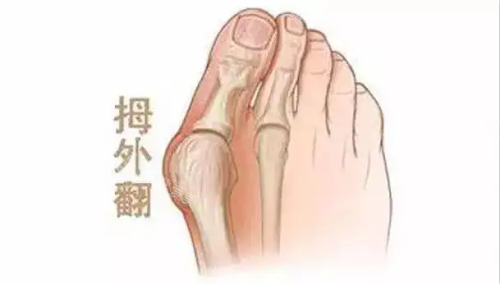 大腳骨示意圖 大腳骨示意圖