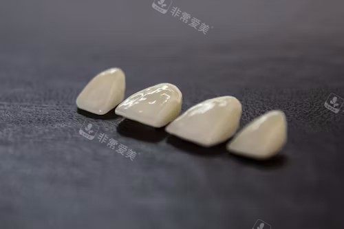 牙冠展示图