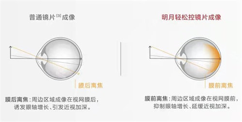 明月轻松控镜片成像