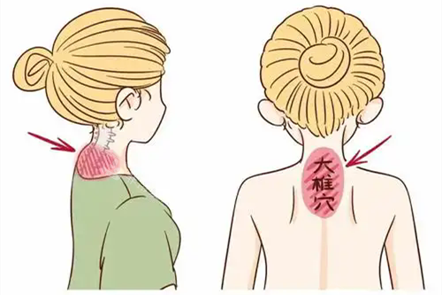 富贵包位置.webp