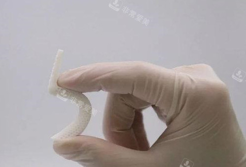 超體隆鼻照片展示圖 超體隆鼻照片展示圖