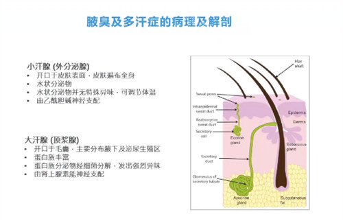 腋臭怎么办