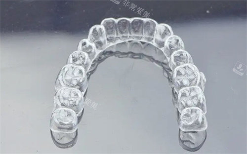 可丽尔隐形矫正牙套